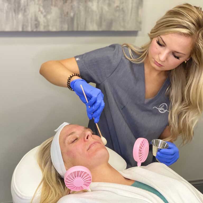 skinceuticals-peel